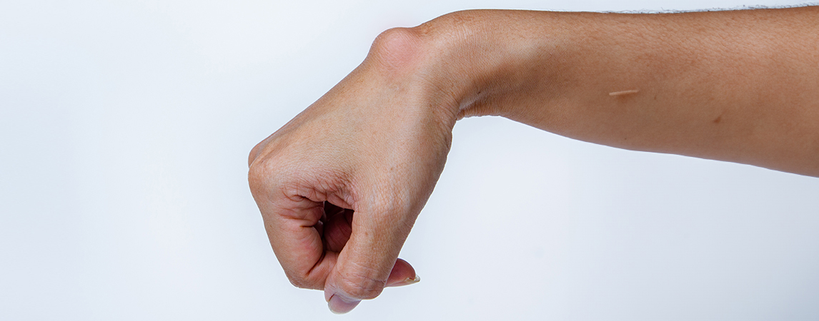 Lumps and Bumps page header