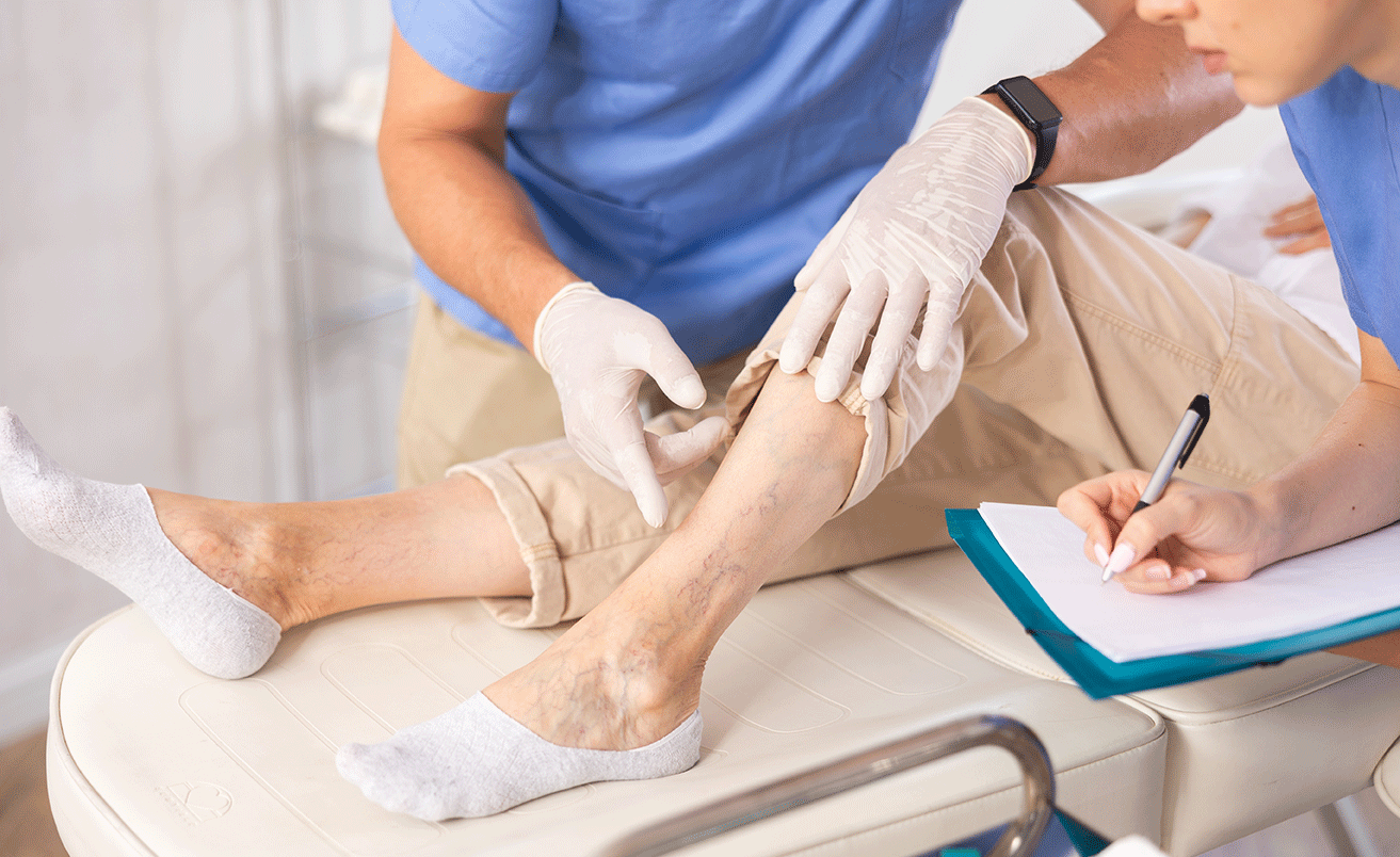 Different Types of Varicose Vein Treatments in Singapore