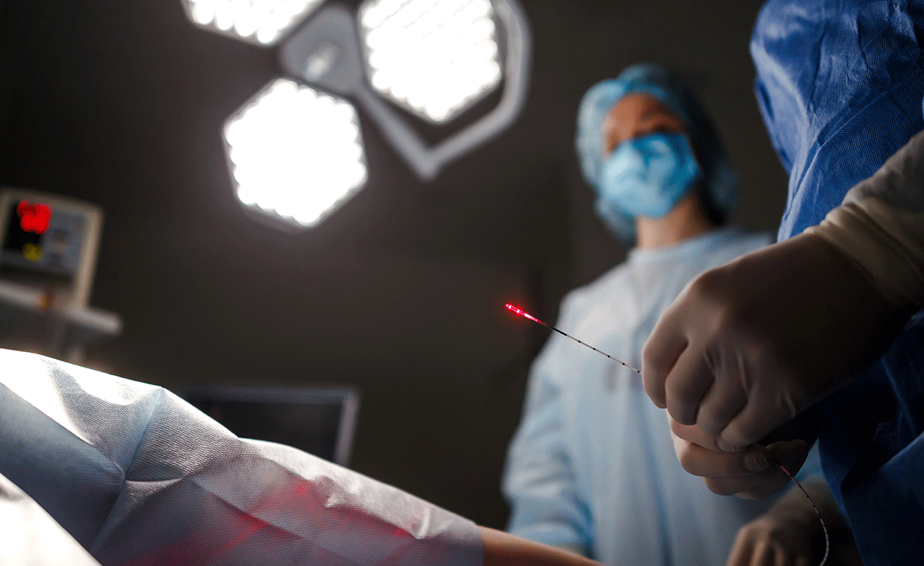 How Is Laser Used for Spider Vein Removal?