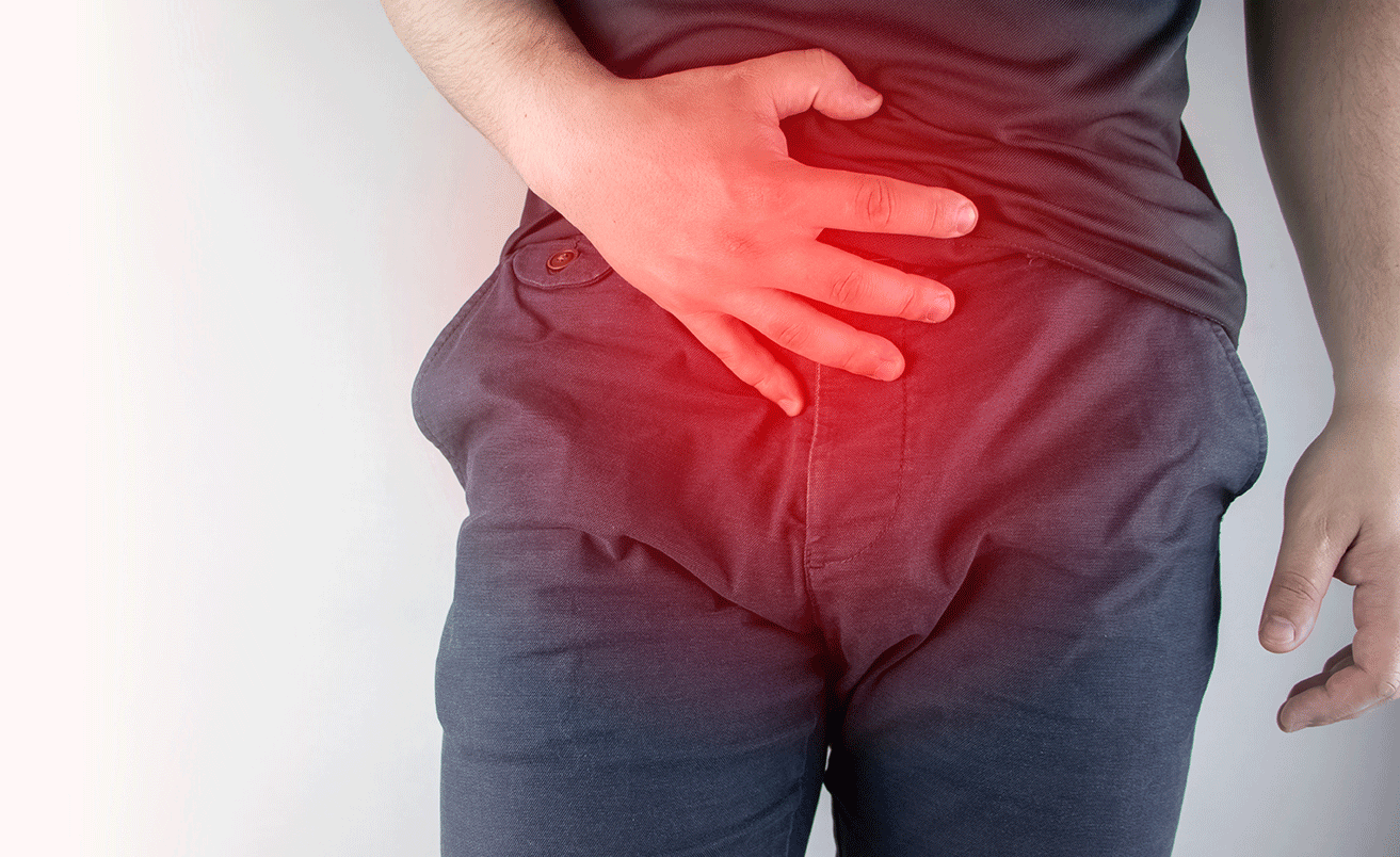 What Are Hernias & When to See a Doctor