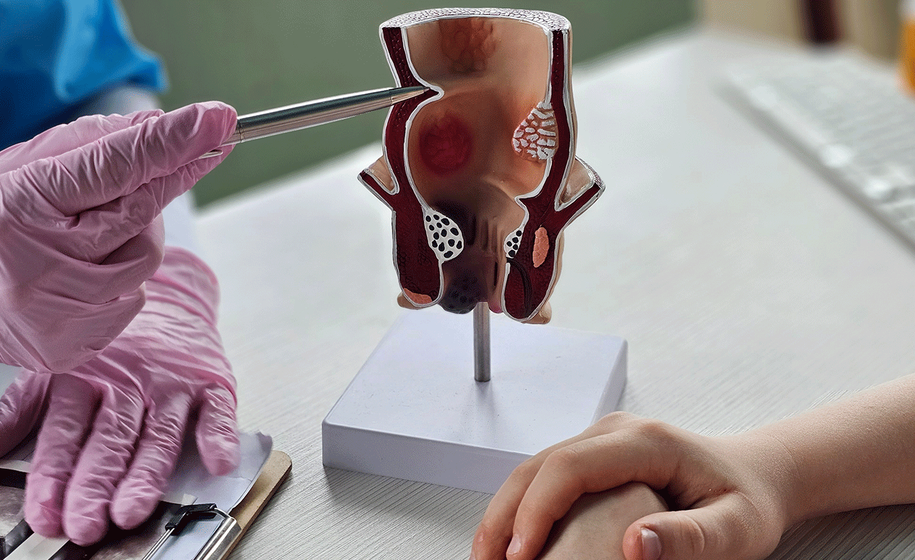 What to Expect During a Colonoscopy