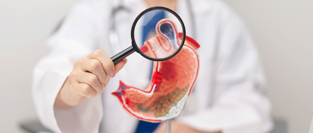 A doctor examining an anatomical diagram of a stomach