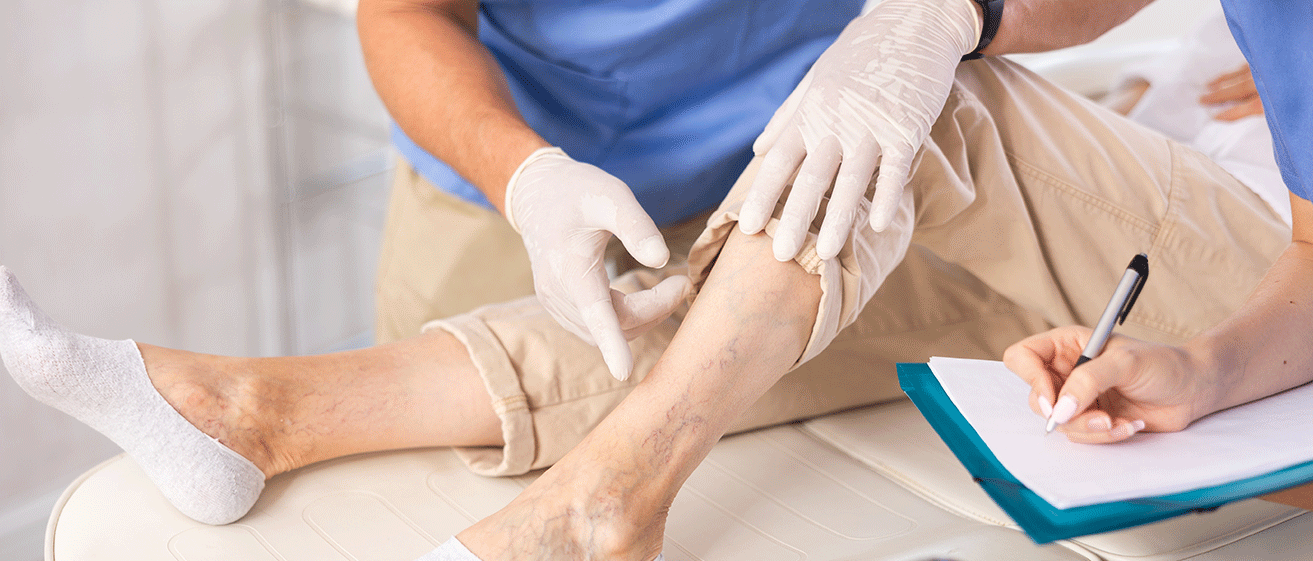 Varicose veins being treated