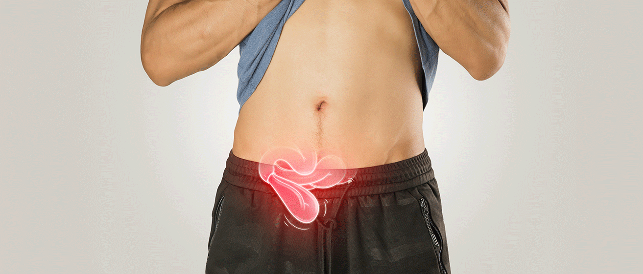 A patient suffering from a hernia