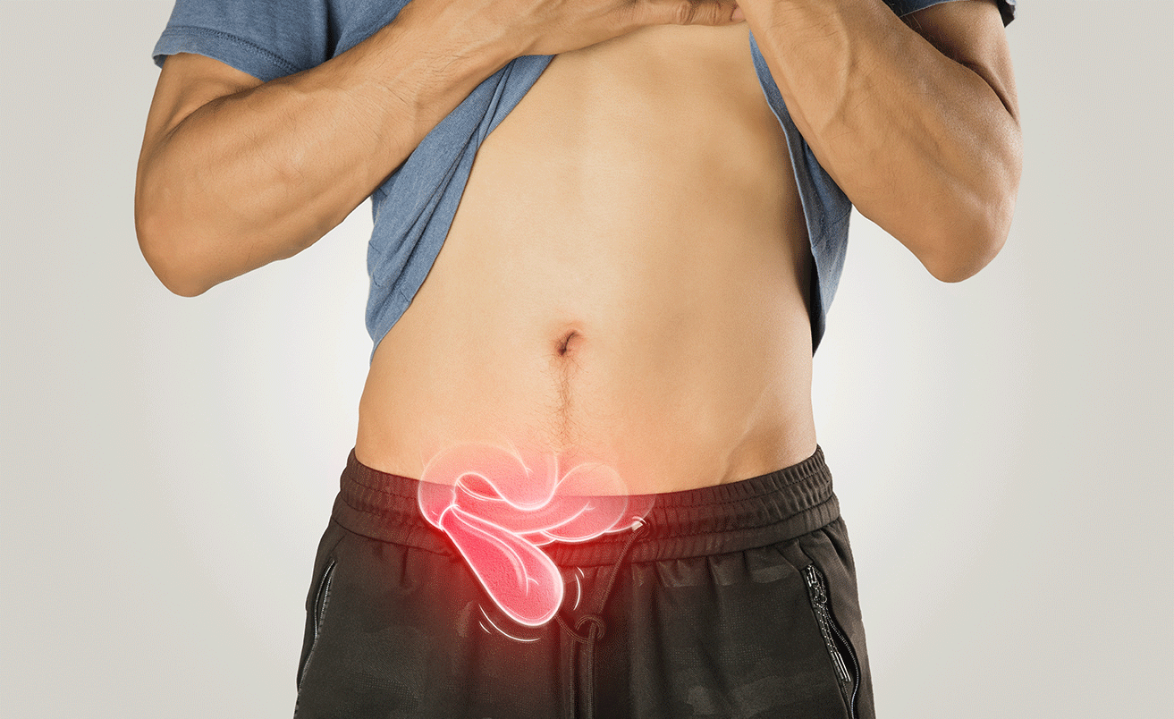 Herniorrhaphy, Hernioplasty and Herniotomy: What’s the Difference?