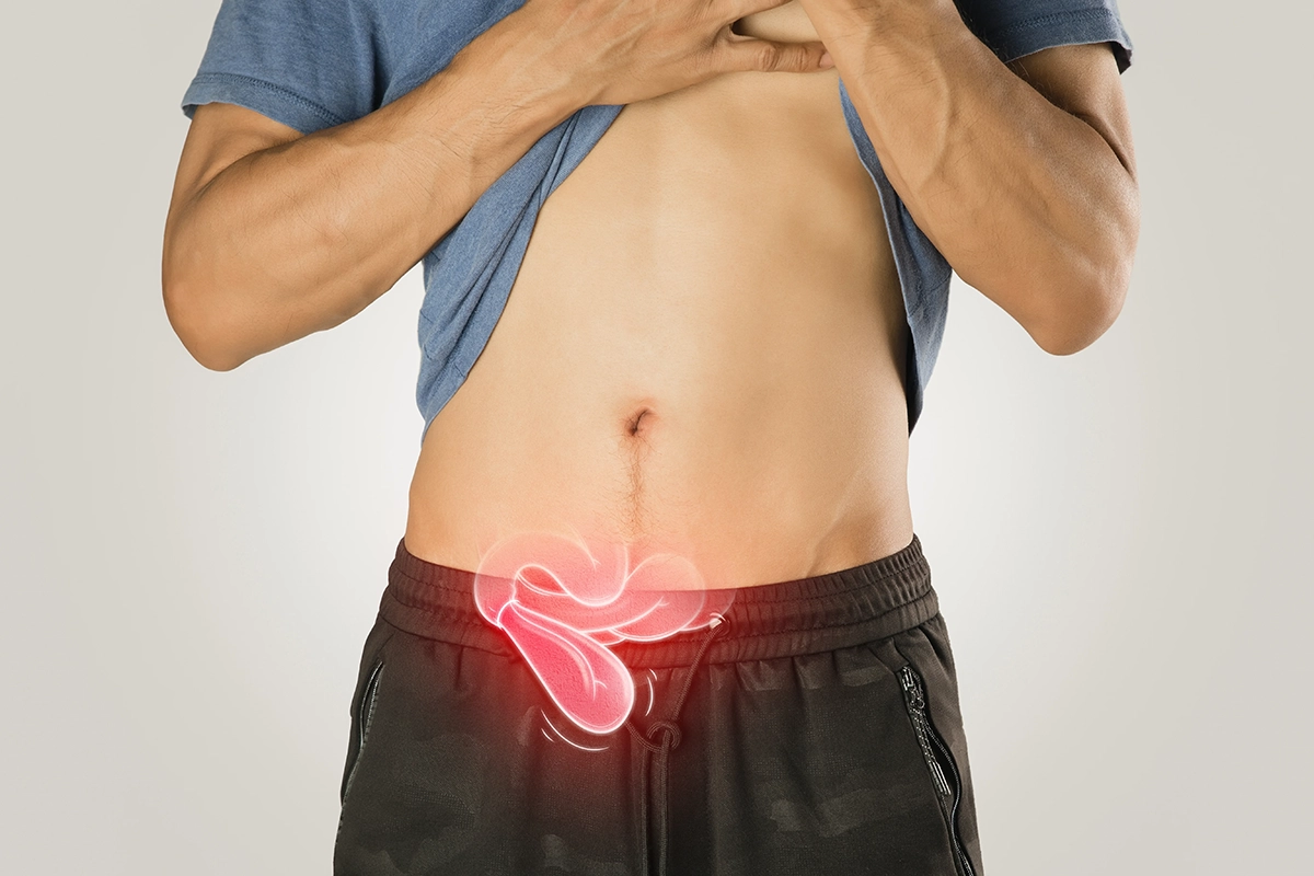 Man with inguinal hernia