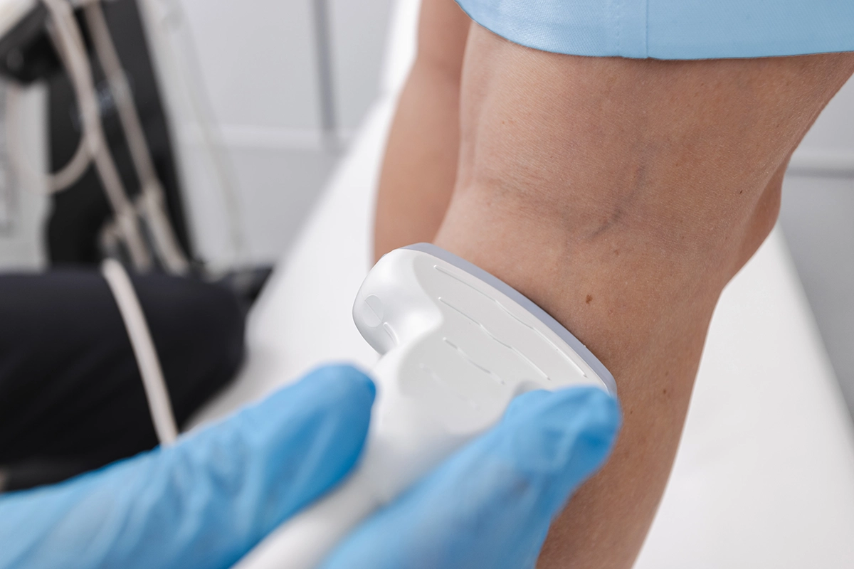 Duplex ultrasound used on a patient’s leg