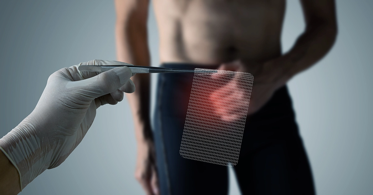 Doctor holding up hernia mesh