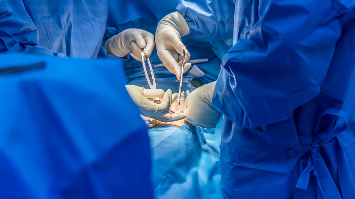Surgeons performing hernia mesh repair