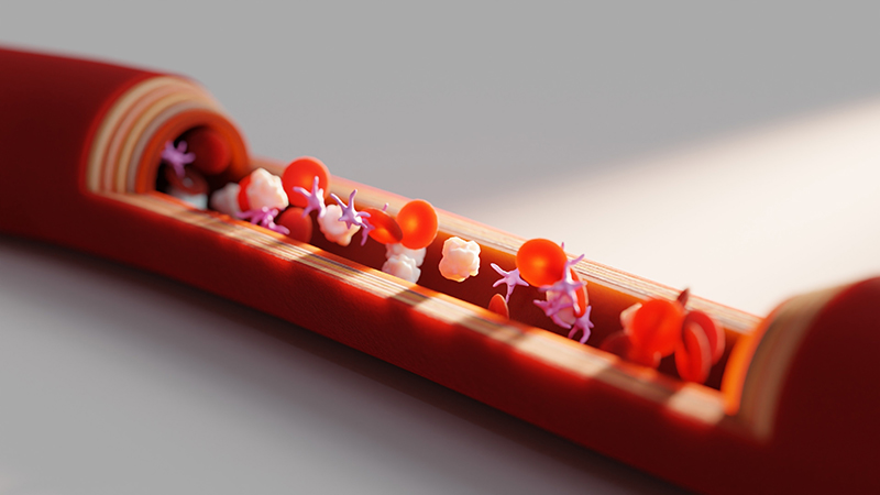 Model of a blood vessel