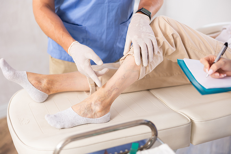 Vein Specialist assessing patient's vein condition