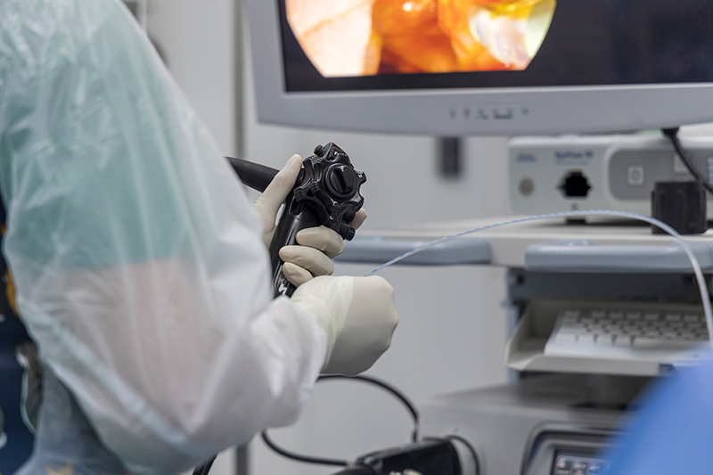 Doctor performing a gastroscopy procedure