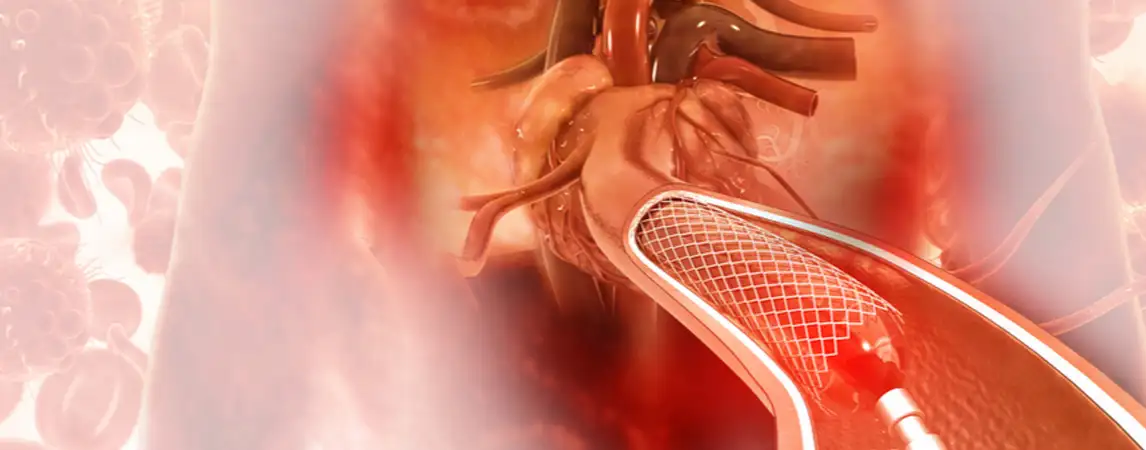 Angioplasty services page header